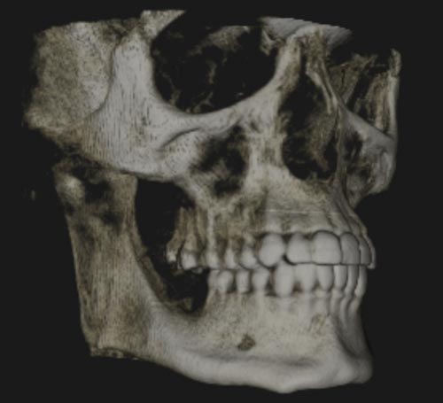 Cone Beam CT - 3D scanning, Oral & Maxillofacial Surgeons Newcastle